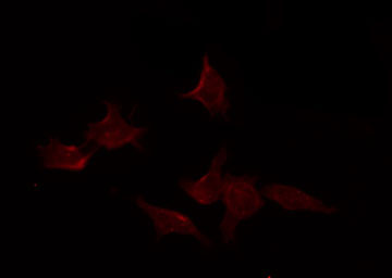 IL15RA Antibody - Staining COLO205 cells by IF/ICC. The samples were fixed with PFA and permeabilized in 0.1% Triton X-100, then blocked in 10% serum for 45 min at 25°C. The primary antibody was diluted at 1:200 and incubated with the sample for 1 hour at 37°C. An Alexa Fluor 594 conjugated goat anti-rabbit IgG (H+L) Ab, diluted at 1/600, was used as the secondary antibody.
