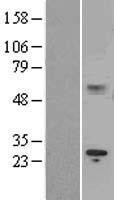 IL15RA Protein - Western validation with an anti-DDK antibody * L: Control HEK293 lysate R: Over-expression lysate