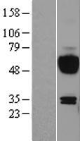 IL15RA Protein - Western validation with an anti-DDK antibody * L: Control HEK293 lysate R: Over-expression lysate