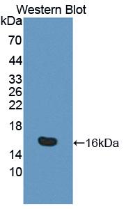 IL16 Antibody - Western blot of IL16 antibody.
