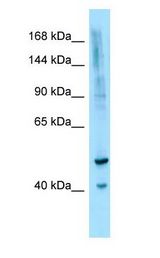 IL16 Antibody - IL16 / IL-16 antibody Western Blot of OVCAR-3.  This image was taken for the unconjugated form of this product. Other forms have not been tested.