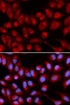 IL16 Antibody - Immunofluorescence analysis of U2OS cells using IL16 antibody. Blue: DAPI for nuclear staining.