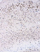 IL16 Antibody - IHC analysis of IL-16 using anti-IL-16 antibody. IL-16 was detected in paraffin-embedded section of mouse brain tissues. Heat mediated antigen retrieval was performed in citrate buffer (pH6, epitope retrieval solution) for 20 mins. The tissue section was blocked with 10% goat serum. The tissue section was then incubated with 1µg/ml rabbit anti-IL-16 Antibody overnight at 4°C. Biotinylated goat anti-rabbit IgG was used as secondary antibody and incubated for 30 minutes at 37°C. The tissue section was developed using Strepavidin-Biotin-Complex (SABC) with DAB as the chromogen.