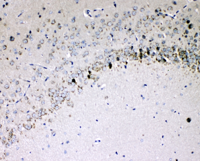 IL16 Antibody - IHC analysis of IL-16 using anti-IL-16 antibody. IL-16 was detected in paraffin-embedded section of rat brain tissues. Heat mediated antigen retrieval was performed in citrate buffer (pH6, epitope retrieval solution) for 20 mins. The tissue section was blocked with 10% goat serum. The tissue section was then incubated with 1µg/ml rabbit anti-IL-16 Antibody overnight at 4°C. Biotinylated goat anti-rabbit IgG was used as secondary antibody and incubated for 30 minutes at 37°C. The tissue section was developed using Strepavidin-Biotin-Complex (SABC) with DAB as the chromogen.