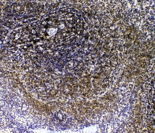 IL16 Antibody - IHC analysis of IL-16 using anti-IL-16 antibody. IL-16 was detected in paraffin-embedded section of rat spleen tissues. Heat mediated antigen retrieval was performed in citrate buffer (pH6, epitope retrieval solution) for 20 mins. The tissue section was blocked with 10% goat serum. The tissue section was then incubated with 1µg/ml rabbit anti-IL-16 Antibody overnight at 4°C. Biotinylated goat anti-rabbit IgG was used as secondary antibody and incubated for 30 minutes at 37°C. The tissue section was developed using Strepavidin-Biotin-Complex (SABC) with DAB as the chromogen.