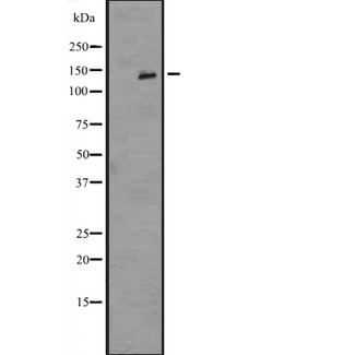 IL16 Antibody - Western blot analysis of IL16 expression in A549 whole cells lysate. The lane on the left is treated with the antigen-specific peptide.