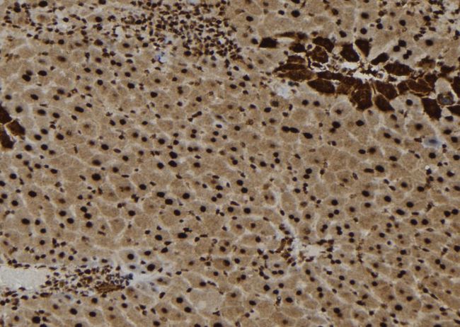 IL16 Antibody - 1:100 staining mouse liver tissue by IHC-P. The sample was formaldehyde fixed and a heat mediated antigen retrieval step in citrate buffer was performed. The sample was then blocked and incubated with the antibody for 1.5 hours at 22°C. An HRP conjugated goat anti-rabbit antibody was used as the secondary.