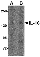 IL16 Antibody - Western blot of IL-16 in rat brain tissue lysate with IL-16 antibody at (A) 1 ug/ml and (B) 2 ug/ml