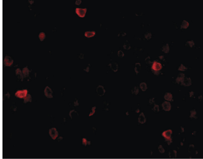 IL16 Antibody - Immunofluorescence of IL-16 in mouse brain tissue with IL-16 antibody at 20 ug/ml.