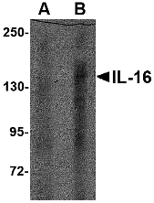 IL16 Antibody - Western blot of IL-16 in rat brain tissue lysate with IL-16 antibody at (A) 1 ug/ml and (B) 2 ug/ml