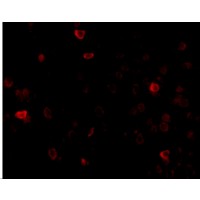 IL16 Antibody - Immunofluorescence of IL-16 in mouse brain tissue with IL-16 antibody at 20 µg/mL.
