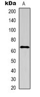 IL16 Antibody - Western blot analysis of IL-16 expression in A549 (A) whole cell lysates.