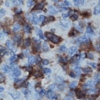 IL16 Antibody - Immunohistochemical analysis of IL-16 staining in human lymph node formalin fixed paraffin embedded tissue section. The section was pre-treated using heat mediated antigen retrieval with sodium citrate buffer (pH 6.0). The section was then incubated with the antibody at room temperature and detected using an HRP polymer system. DAB was used as the chromogen. The section was then counterstained with hematoxylin and mounted with DPX.