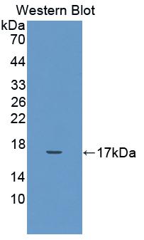 IL17 Antibody - Western blot of IL17 antibody.