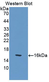 IL17 Antibody - Western blot of IL17 antibody.