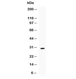 IL17 Antibody - Western blot testing of recombinant mouse IL17 protein (0.5ng/lane) + tag with IL17 antibody at 0.5ug/ml. Predicted molecular weight of native protein: ~17 kDa.