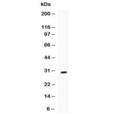 IL17 Antibody - Western blot testing of recombinant mouse IL17 protein (0.5ng/lane) + tag with IL17 antibody at 0.5ug/ml. Predicted molecular weight of native protein: ~17 kDa.