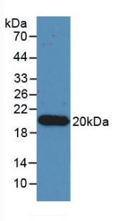 IL17A Antibody - Western Blot; Sample: Recombinant IL17, Human.