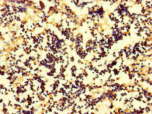 IL17A Antibody - Immunohistochemistry of paraffin-embedded human appendix tissue at dilution of 1:100