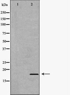 IL17A Antibody - Western blot analysis of extracts of HeLa cells using IL17A antibody. The lane on the left is treated with the antigen-specific peptide.