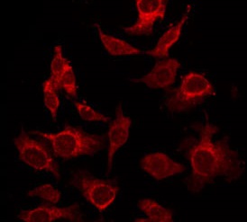 IL17A Antibody - Staining HepG2 cells by IF/ICC. The samples were fixed with PFA and permeabilized in 0.1% Triton X-100, then blocked in 10% serum for 45 min at 25°C. The primary antibody was diluted at 1:200 and incubated with the sample for 1 hour at 37°C. An Alexa Fluor 594 conjugated goat anti-rabbit IgG (H+L) Ab, diluted at 1/600, was used as the secondary antibody.