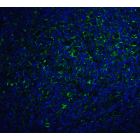 IL17A Antibody - Immunofluorescence of IL-17 in human tonsil tissue with IL-17 antibody at 20 µg/ml.