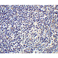 IL17A Antibody - Immunohistochemistry of IL-17 in human tonsil tissue with IL-17 antibody at 5 µg/ml.
