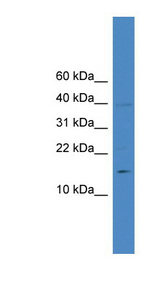 IL17A Antibody - IL17A / IL-17 antibody Western blot of MCF7 cell lysate. This image was taken for the unconjugated form of this product. Other forms have not been tested.