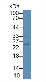 IL17B Antibody - Western Blot; Sample: Mouse Pancreas lysate; Primary Ab: 2µg/mL Rabbit Anti-Human IL17B Antibody Second Ab: 0.2µg/mL HRP-Linked Caprine Anti-Rabbit IgG Polyclonal Antibody