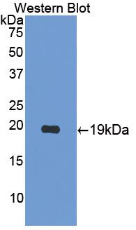 IL17B Antibody - Western Blot; Sample: Recombinant protein.