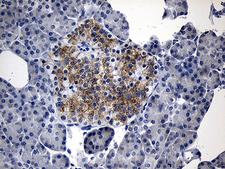 IL17B Antibody - Immunohistochemical staining of paraffin-embedded Human pancreas tissue within the normal limits using anti-IL17B mouse monoclonal antibody. (Heat-induced epitope retrieval by 1mM EDTA in 10mM Tris buffer. (pH8.5) at 120°C for 3 min. (1:500)