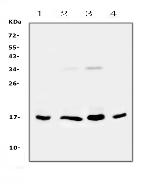 IL17B Antibody - Western blot analysis of IL17B using anti-IL17B antibody. Electrophoresis was performed on a 5-20% SDS-PAGE gel at 70V (Stacking gel) / 90V (Resolving gel) for 2-3 hours. The sample well of each lane was loaded with 50ug of sample under reducing conditions. Lane 1: rat gaster tissue lysates,Lane 2: human COLO-320 whole cell lysates,Lane 3: human Hela whole cell lysates,Lane 4: human SGC-7901 whole cell lysates. After Electrophoresis, proteins were transferred to a Nitrocellulose membrane at 150mA for 50-90 minutes. Blocked the membrane with 5% Non-fat Milk/ TBS for 1.5 hour at RT. The membrane was incubated with rabbit anti-IL17B antigen affinity purified polyclonal antibody at 0.5 ug/mL overnight at 4?, then washed with TBS-0.1% Tween 3 times with 5 minutes each and probed with a goat anti-rabbit IgG-HRP secondary antibody at a dilution of 1:10000 for 1.5 hour at RT. The signal is developed using an Enhanced Chemiluminescent detection (ECL) kit with Tanon 5200 system. A specific band was detected for IL17B at approximately 17KD. The expected band size for IL17B is at 20KD.