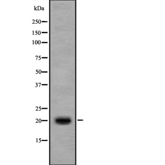 IL17B Antibody - Western blot analysis IL17B using Jurkat whole cells lysates
