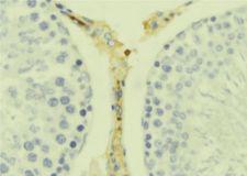 IL17B Antibody - 1:100 staining mouse testis tissue by IHC-P. The sample was formaldehyde fixed and a heat mediated antigen retrieval step in citrate buffer was performed. The sample was then blocked and incubated with the antibody for 1.5 hours at 22°C. An HRP conjugated goat anti-rabbit antibody was used as the secondary.