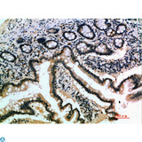 IL17B Antibody - Immunohistochemical analysis of paraffin-embedded human-small-intestine, antibody was diluted at 1:200.