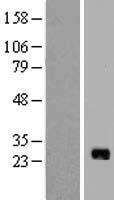 IL17B Protein - Western validation with an anti-DDK antibody * L: Control HEK293 lysate R: Over-expression lysate
