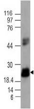 IL17C Antibody - Fig-1: Western blot analysis of IL-17C. Anti-IL-17C antibody was tested at 2 µg/ml on A549 cell lysate.