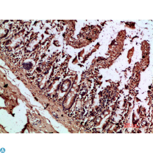 IL17C Antibody - Immunohistochemical analysis of paraffin-embedded human-colon, antibody was diluted at 1:200.