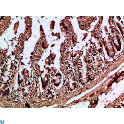 IL17C Antibody - Immunohistochemical analysis of paraffin-embedded human-colon, antibody was diluted at 1:200.