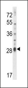 IL17D Antibody - IL17D Antibody western blot of NCI-H460 cell line lysates (35 ug/lane). The IL17D antibody detected the IL17D protein (arrow).