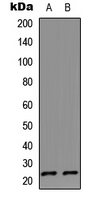 IL17D Antibody - Western blot analysis of IL-17D expression in HeLa (A); Jurkat (B) whole cell lysates.