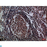 IL17D Antibody - Immunohistochemical analysis of paraffin-embedded Human-tonsil, antibody was diluted at 1:100.