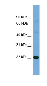 IL17D Antibody - IL17D antibody Western blot of Placenta lysate. This image was taken for the unconjugated form of this product. Other forms have not been tested.