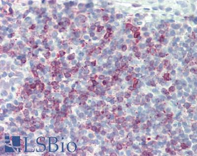 IL17F Antibody - Human Tonsil: Formalin-Fixed, Paraffin-Embedded (FFPE)