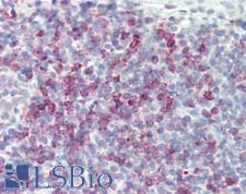 IL17F Antibody - Human Tonsil: Formalin-Fixed, Paraffin-Embedded (FFPE)
