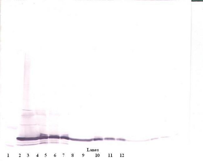 IL17F Antibody - Western Blot (reducing) of IL-17F antibody. This image was taken for the unconjugated form of this product. Other forms have not been tested.