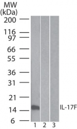 IL17F Antibody - Western blot of IL-17F in 1) human, 2) mouse and 3) rat full-length recombinant IL-17F protein (20 ng/lane) using Monoclonal Antibody to IL-17F (Clone 4H1629) at 0.5 ug/ml.