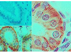 IL17F Antibody - Immunohistochemistry of Mouse Anti-IL-17F antibody. Tissue: human colon tissue. Fixation: formalin-fixed, paraffin-embedded. Primary antibody: isotype control (top left), Mouse Anti-IL-17F antibody at 5 ug/ml.