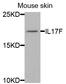 IL17F Antibody - Western blot analysis of extracts of mouse skin cells.