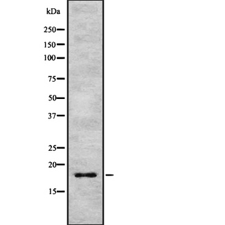 IL17F Antibody - Western blot analysis IL17F using HeLa whole cells lysates